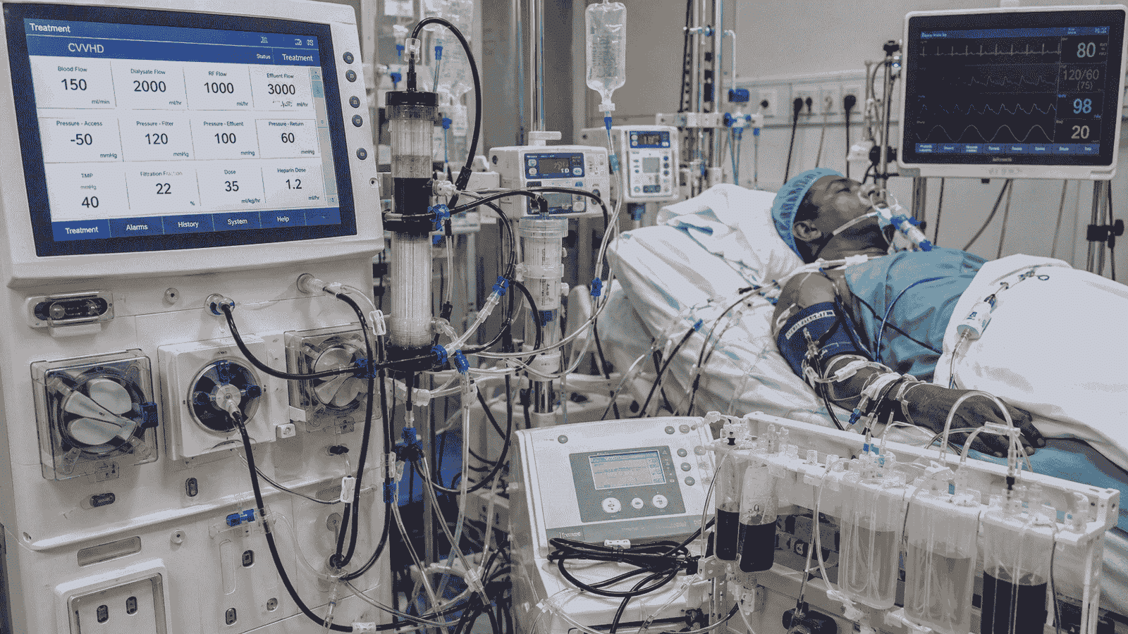 RRT & Extracorporeal Therapies